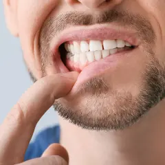 Mężczyzna pokazuje palcem zęby, zwracając uwagę na diastemę.