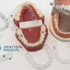 Przezroczyste nakładki na zęby, jak te dostępne w aptece, prezentowane na modelach szczęk.