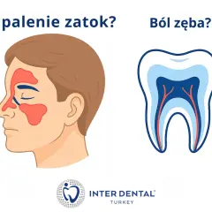 Ilustracja przedstawia profil twarzy z zaznaczonym zapaleniem zatok szczękowych obok przekroju zęba.