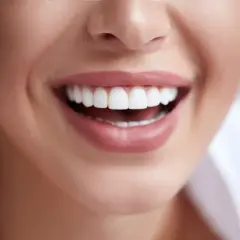 Uśmiech jak z reklamy, dzięki białej diecie i zabiegom.