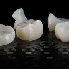 Kilka białych, ceramicznych koron dentystycznych leży na czarnym, błyszczącym tle.