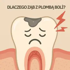 Smutny ząb z plombą i błyskawicami bólu. Dlaczego ząb z plombą boli przy nagryzaniu?
