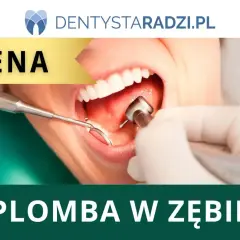 Dentysta wykonuje zabieg w jamie ustnej. Na pasku widnieje napis "CENA", a poniżej "PLOMBA W ZĘBIE". Dowiedz się, ile kosztuje plomba.