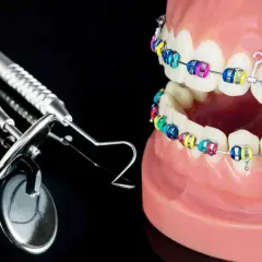 Kolorowy aparat ortodontyczny na modelach szczęk, symbolizujący korektę zgryzu krzyżowego przed i po. Obok narzędzia dentystyczne.