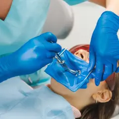 Dentysta zakłada koferdam pacjentowi, izolując pole zabiegowe.