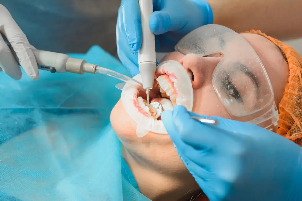 Profesjonalna higienizacja zębów. Dentysta ultradźwiękami usuwa kamień, dbając o zdrowy uśmiech pacjenta.