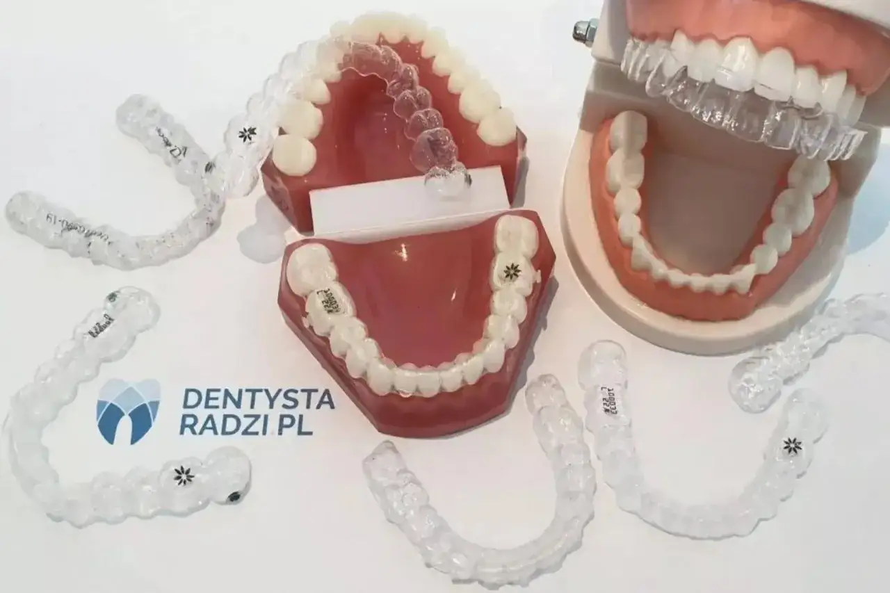 Przezroczyste nakładki na zęby, jak te dostępne w aptece, prezentowane na modelach szczęk.
