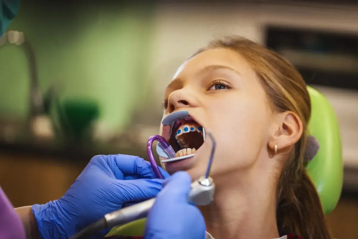 Dziewczynka z niebieskim aparatem ortodontycznym dla dzieci u dentysty.