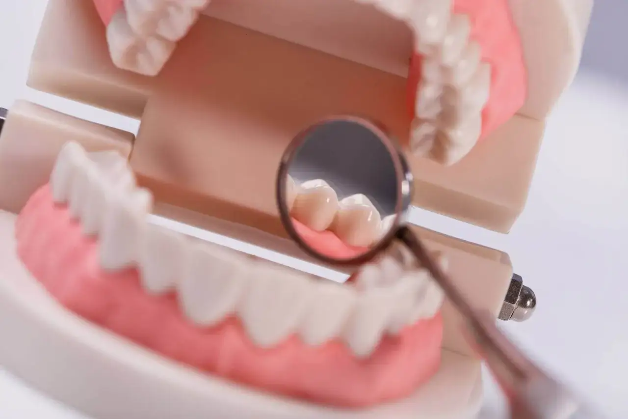 Model szczęki z zębami, odbicie w lusterku dentystycznym. Wyobraź sobie, jak fibryna bogatopłytkowa wspiera regenerację dziąseł.