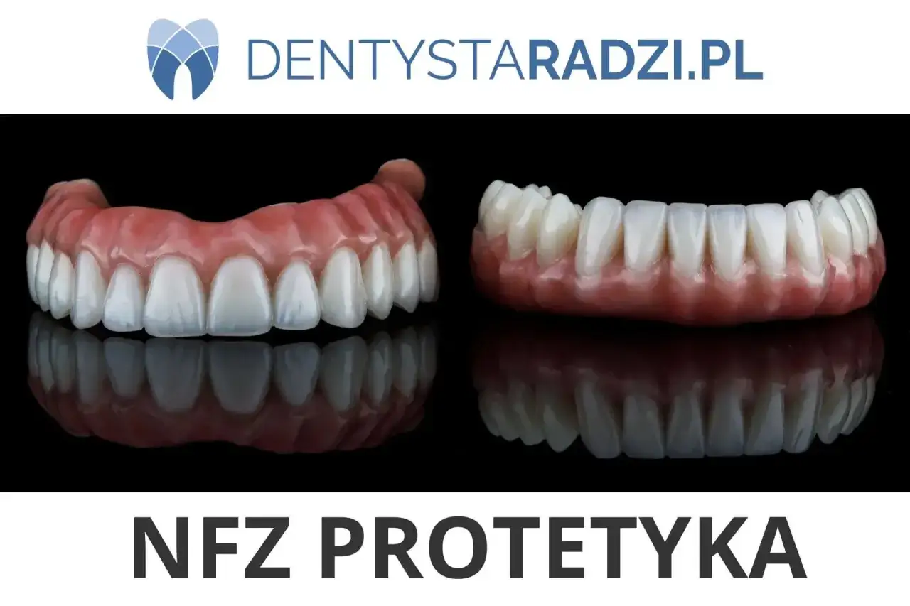 Dwa rodzaje protez zębowych, górna i dolna, prezentują estetykę i funkcjonalność. Sprawdź, jaka jest most protetyczny cena.