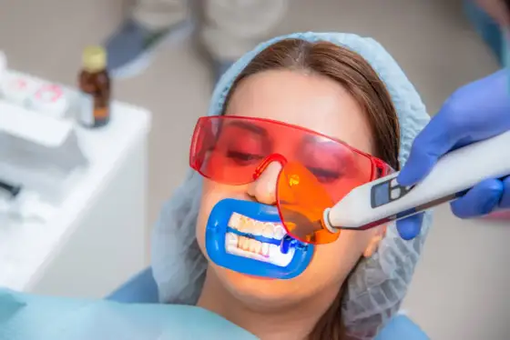 Ból zębów po wybielaniu - ile trwa i kiedy do dentysty?