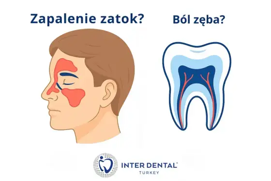 Ból zęba nie mija? Sprawdź, co może oznaczać i kiedy iść do dentysty