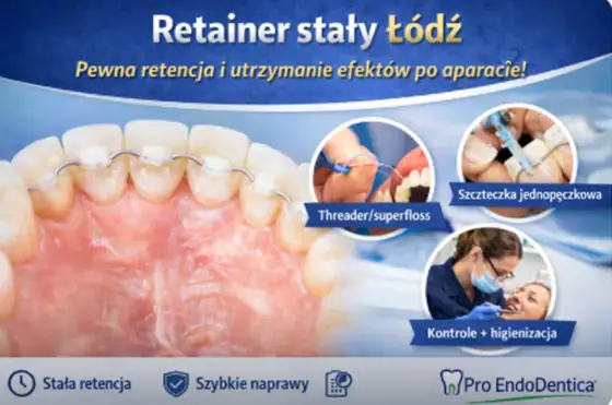 Retainer stały - czy warto? Koszty, higiena, problemy