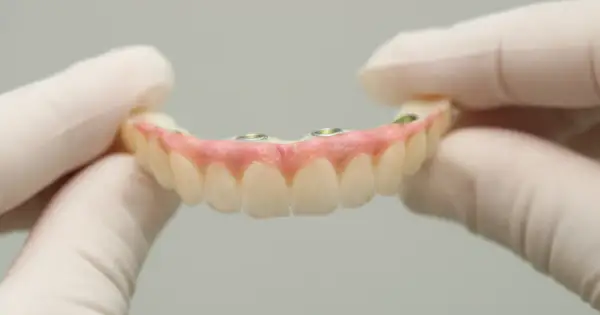 Górna proteza bez podniebienia, mocowana na implantach, prezentowana przez dłonie w rękawiczkach.