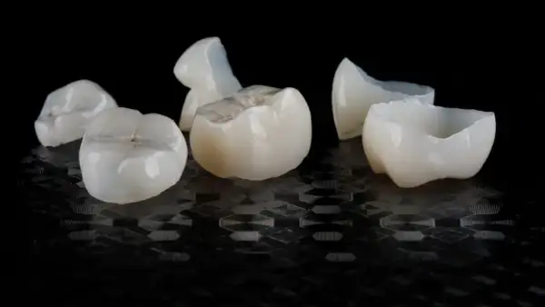 Kilka białych, ceramicznych koron dentystycznych leży na czarnym, błyszczącym tle.