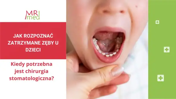 Dziecko z otwartymi ustami, widoczne nieprawidłowe wyrzynanie się zębów stałych. Tekst informuje o zatrzymanych zębach u dzieci i chirurgii stomatologicznej.