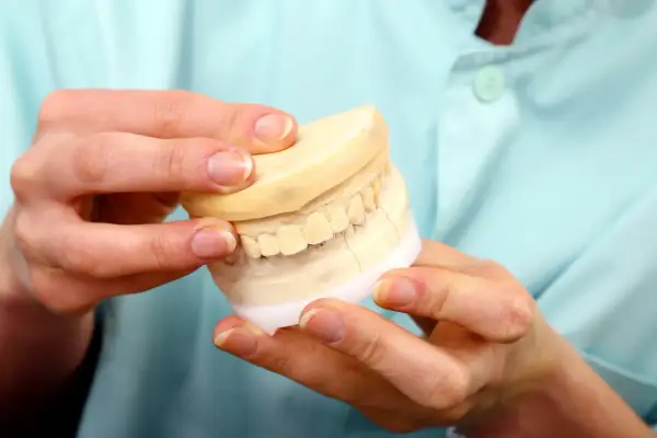 Model szczęki z widocznym pęknięciem, sugerującym, że wypadł implant zęba po kilku latach.